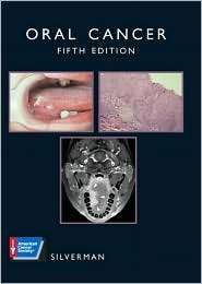 Oral Cancer, (1550092154), Sol Silverman, Textbooks   