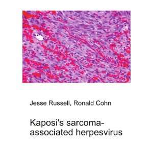  Kaposis sarcoma associated herpesvirus Ronald Cohn Jesse 