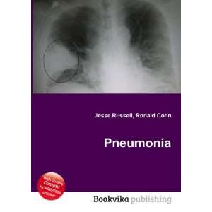  Pneumonia Ronald Cohn Jesse Russell Books